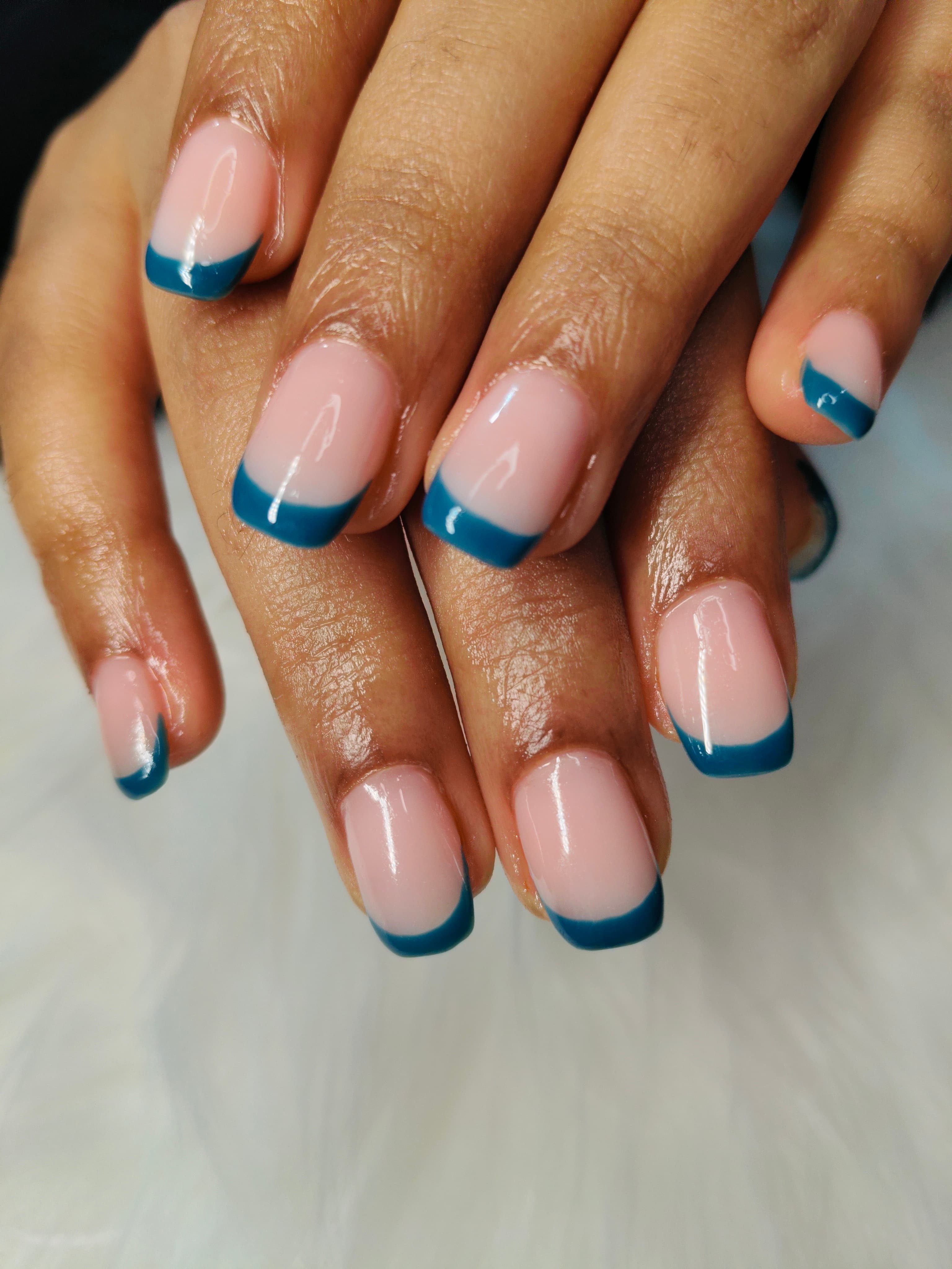 Gum Gel Refill – photo 2